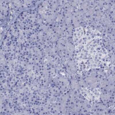 Immunohistochemistry-Paraffin: ENPP6 Antibody [NBP3-17051]