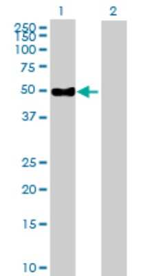 Western Blot: ENPP6 Antibody [H00133121-B01P]