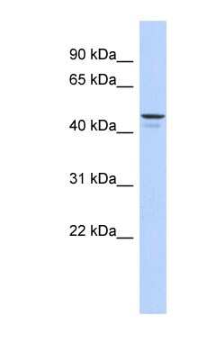 Western Blot: ENPP6 Antibody [NBP1-57954]