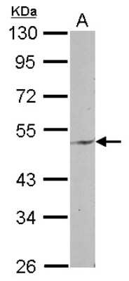 Western Blot: ENPP6 Antibody [NBP2-16340]