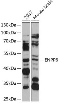 Western Blot: ENPP6 AntibodyAzide and BSA Free [NBP3-05183]