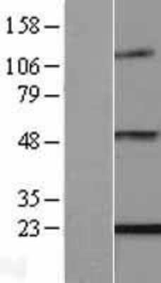 Western Blot: ENPP6 Overexpression Lysate [NBL1-10278]