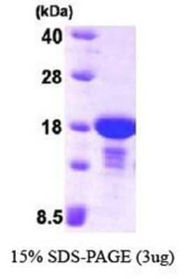 SDS-PAGE: Recombinant Human alpha Endosulfine His Protein [NBP1-37076]