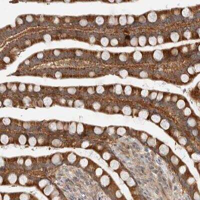 Immunohistochemistry-Paraffin: ENT1 Antibody [NBP1-84838]