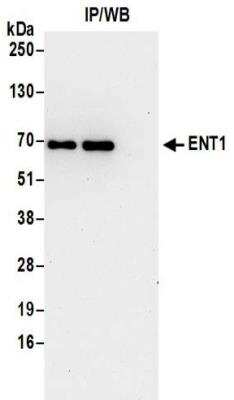 Immunoprecipitation: ENT1 Antibody [NBP2-32223]