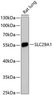 Western Blot: ENT1 AntibodyAzide and BSA Free [NBP3-02976]