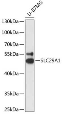 Western Blot: ENT1 AntibodyAzide and BSA Free [NBP3-02977]