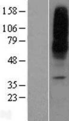 Western Blot: ENT1 Overexpression Lysate [NBL1-16091]