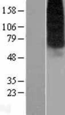 Western Blot: ENT1 Overexpression Lysate [NBP2-10638]