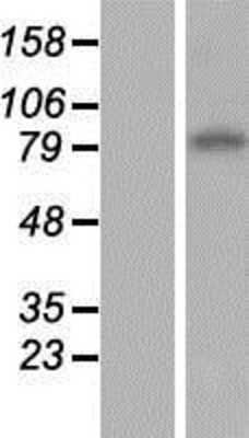 Western Blot: ENT1 Overexpression Lysate [NBP2-11449]