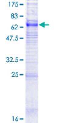 SDS-PAGE: Recombinant Human ENT1 GST (N-Term) Protein [H00002030-P01]