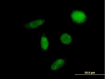 Immunocytochemistry/ Immunofluorescence: ENT2 Antibody [H00003177-B02P]