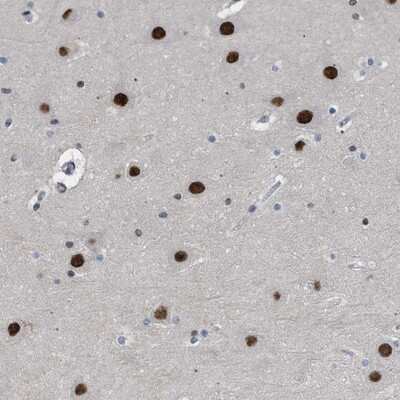 Immunohistochemistry-Paraffin: ENT2 Antibody [NBP1-85253]