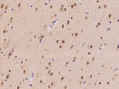 Immunohistochemistry-Paraffin: ENT2 Antibody [NBP2-98674]