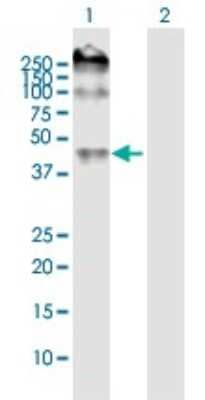 Western Blot: ENT2 Antibody [H00003177-B02P]