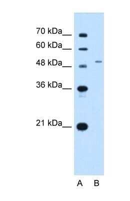 Western Blot: ENT2 Antibody [NBP1-69312]