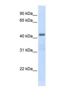 Western Blot: ENT2 Antibody [NBP1-69313]