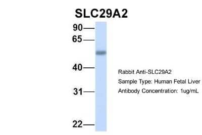 Western Blot: ENT2 Antibody [NBP1-69313]