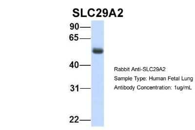 Western Blot: ENT2 Antibody [NBP1-69313]