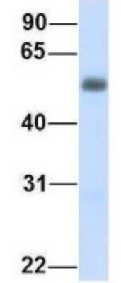 Western Blot: ENT2 Antibody [NBP1-69313]