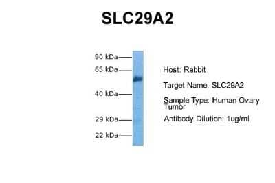 Western Blot: ENT2 Antibody [NBP1-69313]