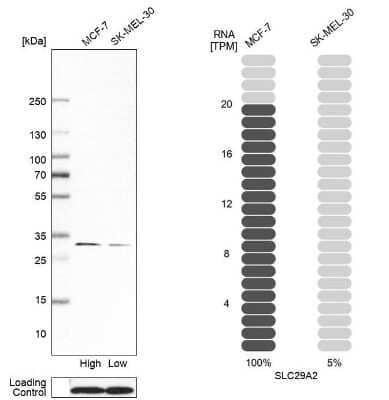 Western Blot: ENT2 Antibody [NBP1-85253]