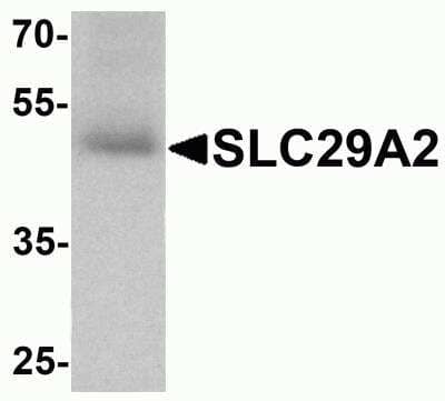 Western Blot: ENT2 AntibodyBSA Free [NBP2-81984]