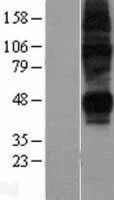 Western Blot: ENT2 Overexpression Lysate [NBL1-16092]