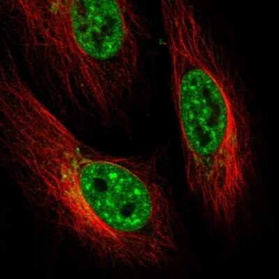 Immunocytochemistry/ Immunofluorescence: ENTHD2 Antibody [NBP2-55976]
