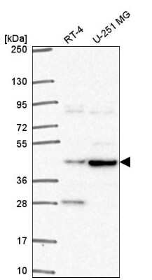 Western Blot: ENTHD2 Antibody [NBP2-55976]