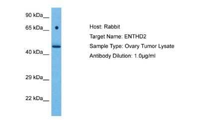 Western Blot: ENTHD2 Antibody [NBP2-83005]