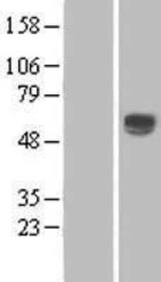 Western Blot: CD39L1/ENTPD2 Overexpression Lysate [NBL1-10281]