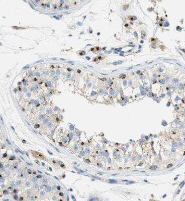 Immunohistochemistry-Paraffin: ENTPD4 Antibody [NBP1-81510]