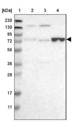 Western Blot: ENTPD4 Antibody [NBP1-81510]