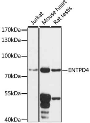 Western Blot: ENTPD4 AntibodyAzide and BSA Free [NBP3-04978]