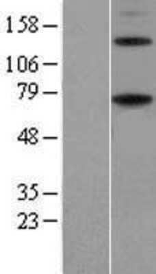 Western Blot: ENTPD4 Overexpression Lysate [NBP2-07812]