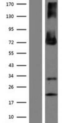 Western Blot: ENTPD4 Overexpression Lysate [NBP2-09491]