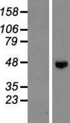 Western Blot: CD39L4/ENTPD5 Overexpression Lysate [NBP2-08223]