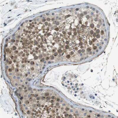 Immunohistochemistry-Paraffin: ENTPD7 Antibody [NBP1-82030]