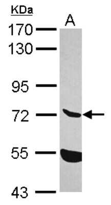 Western Blot: ENTPD7 Antibody [NBP2-16343]