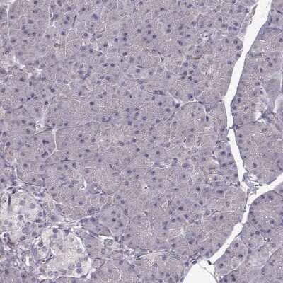 Immunohistochemistry-Paraffin: ENTPD8 Antibody [NBP1-82517]