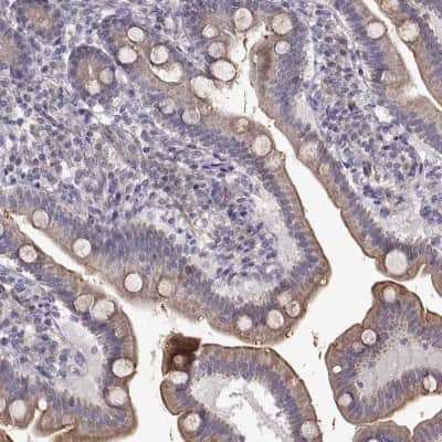Immunohistochemistry-Paraffin: ENTPD8 Antibody [NBP1-82517]