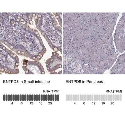 Immunohistochemistry-Paraffin: ENTPD8 Antibody [NBP1-82517]