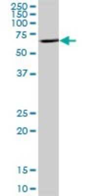 Western Blot: ENTPD8 Antibody [H00377841-B01P]