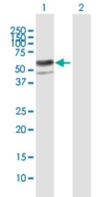Western Blot: ENTPD8 Antibody [H00377841-B01P]