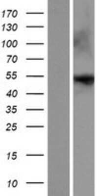 Western Blot: ENTPD8 Overexpression Lysate [NBP2-08622]