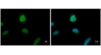 Immunocytochemistry/ Immunofluorescence: ENY2 Antibody (245) [NBP2-43547]