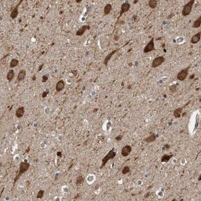 Immunohistochemistry-Paraffin: ENY2 Antibody [NBP1-90598]