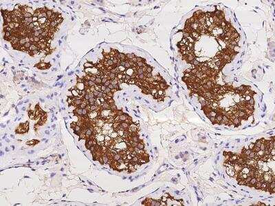 Immunohistochemistry-Paraffin: ENY2 Antibody [NBP3-06133]