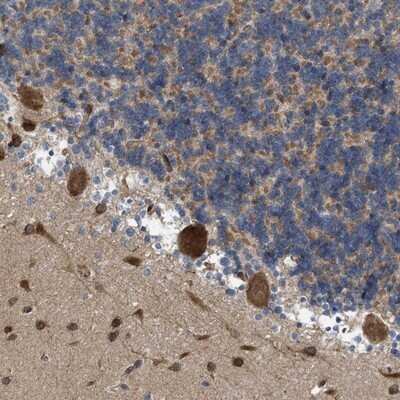 Immunohistochemistry-Paraffin: EOGT/AER61 Antibody [NBP1-90224]